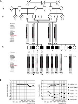 SLC22A4 Gene in Hereditary Non-syndromic Hearing Loss: Recurrence and Incomplete Penetrance of the p.C113Y Mutation in Northwest Africa